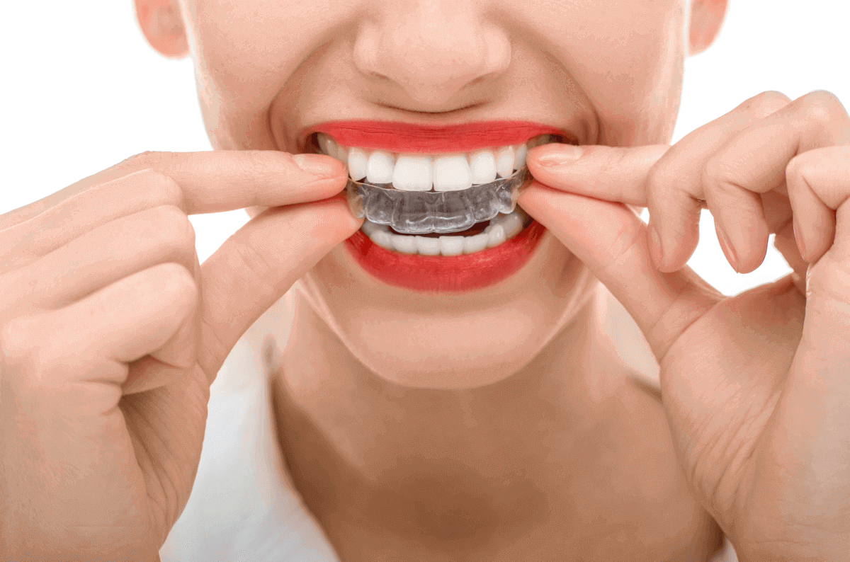 how invisalign can transform your appearance