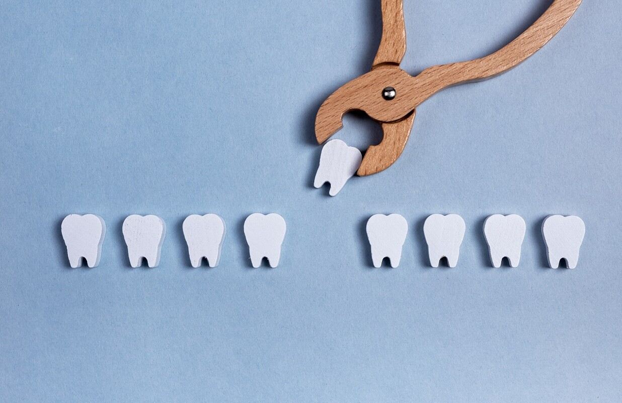 the pros and cons of wisdom tooth extraction making an informed decision