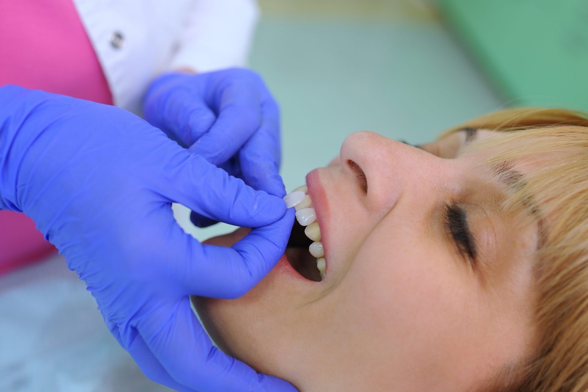 10 simple steps to get your teeth prepared for veneers