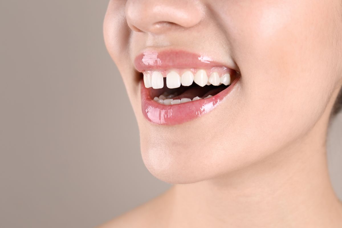 how do dental bridges help to fill the gap between your teeth