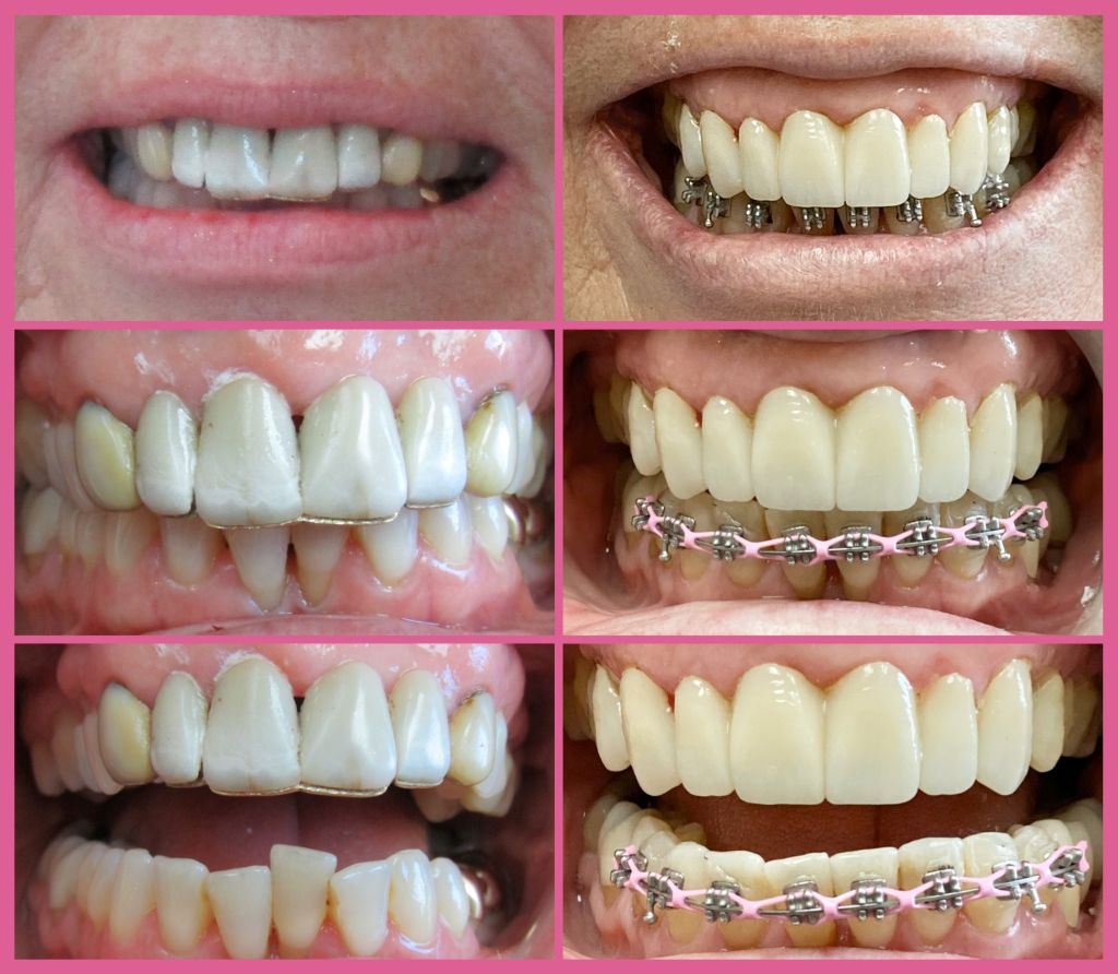 Smile様おまとめ Smile Transformations Near Me in Indian Land, SC