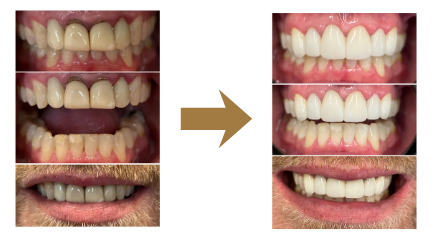 Smile Transformations Near Me in Indian Land, SC