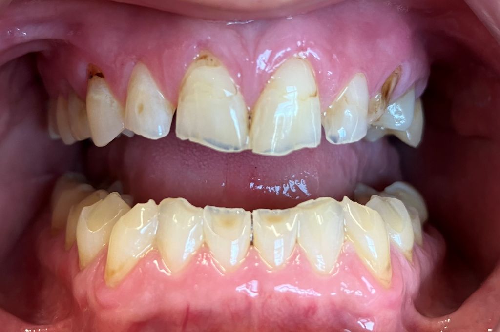 Smile Transformations Near Me in Indian Land, SC