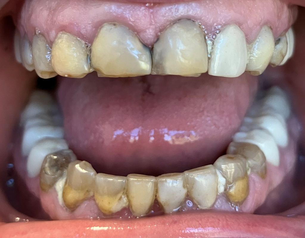 Smile Transformations Near Me in Indian Land, SC